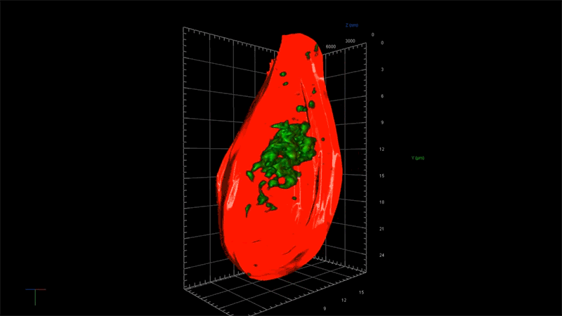 Super-resolution microscopy reveals cell body infiltrated with toxic tau