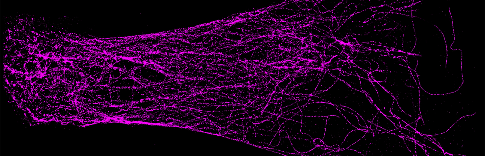 Super-resolution techniques reveal tubulin proteins (purple) in a neuron.