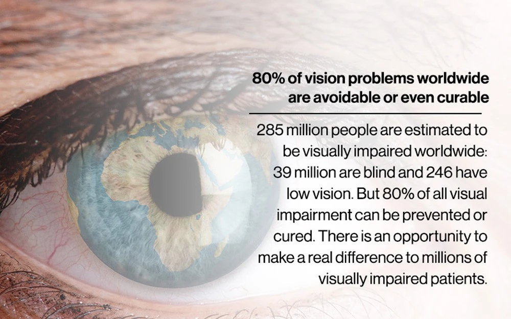 Eye fact 7
