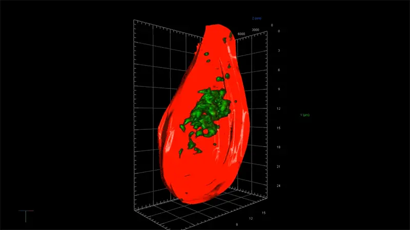 Super-resolution microscopy reveals cell body infiltrated with toxic tau