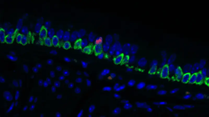 A pulmonary ionocyte