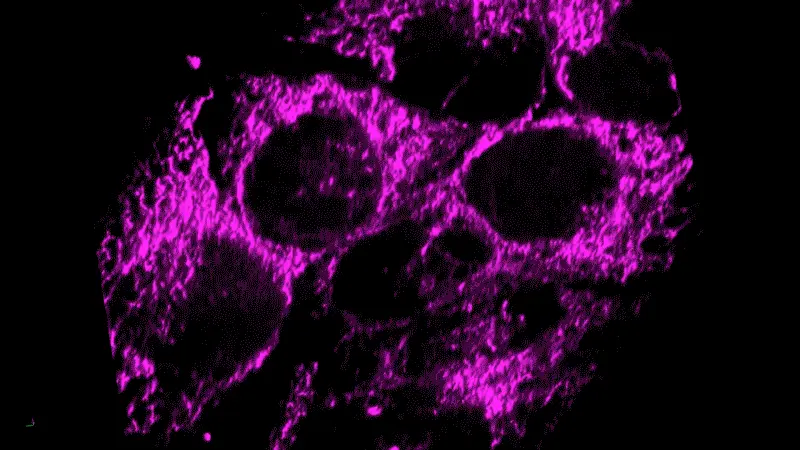 Live cell imaging of inflammation in a tumor model.