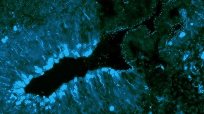Close-up of the brain