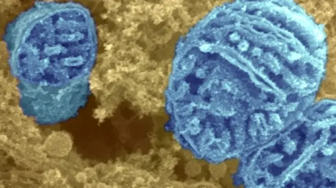 Stopping free radicals at their source