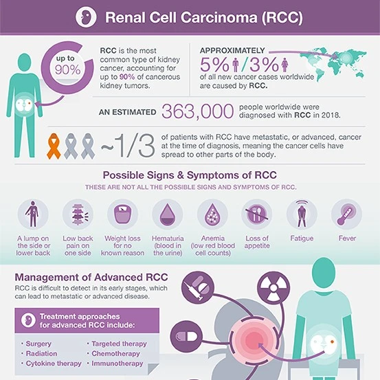 RCC Infographic
